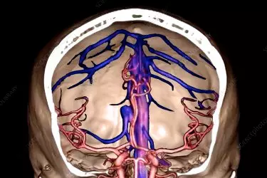 best diagnostic centre for ct angiography, best diagnostic centre in gurgaon, ct renal angiography, ct angiography neck vessels, ct angiography of the heart, ct angiography of peripheral vessels, ct angiography of the brain