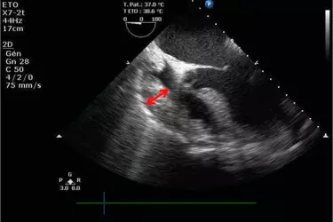 2D Echocardiography in Gurgaon, Cost of 2D Echo in Gurgaon, Echocardiography of Heart in Gurgaon, Echo Test in Gurgaon, Stress Echocardiography in Gurgaon, Best echo centre in gurgaon.