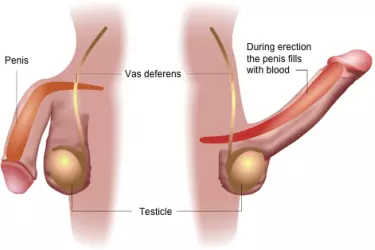 best hospital for penile doppler test, best doctor for penile doppler test, penile doppler test in gurgaon, penile doppler test in india, cost of penile doppler test