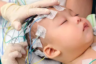 EEG Test in Gurgaon by Neurologist, EEG Test for Epilepsy in Gurgaon, Cost of EEG Test in Gurgaon, Where can EEG Test be done in Gurgaon, Best Neurology Hospital for EEG Test in Gurgaon