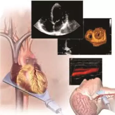 Best Echocardiography Test in Gurgaon for heart health